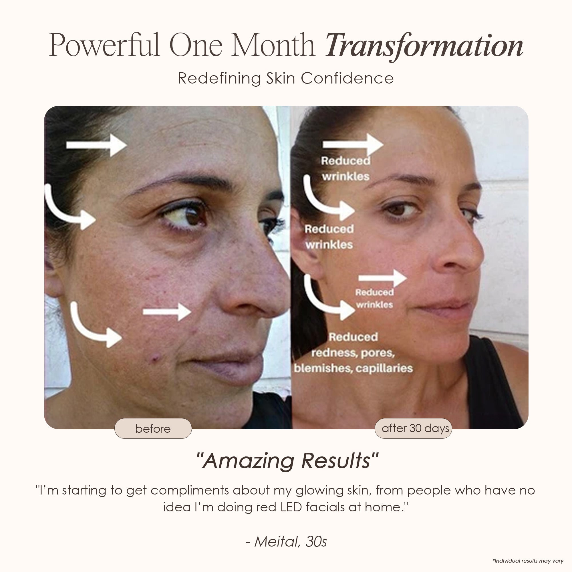 LightAura LED face mask before and after where there were less redness, wrinkles, and blemishes after 30 days